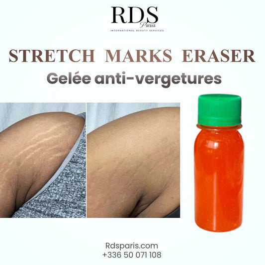 STRETCH MARKS ERASER